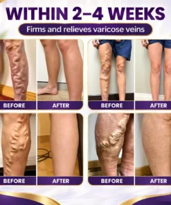 LUHAKA™ VeinRelief Cooling Herbal Leg Gel