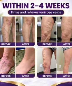 LUHAKA™ VeinRelief Cooling Herbal Leg Gel